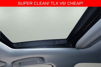 2015 Acura TLX V6