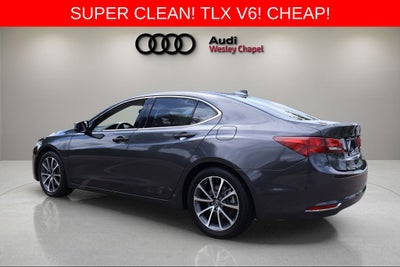 2015 Acura TLX V6